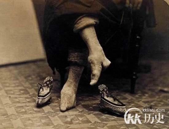中国古代女子缠足的历史:清末恐怖的女人缠足照