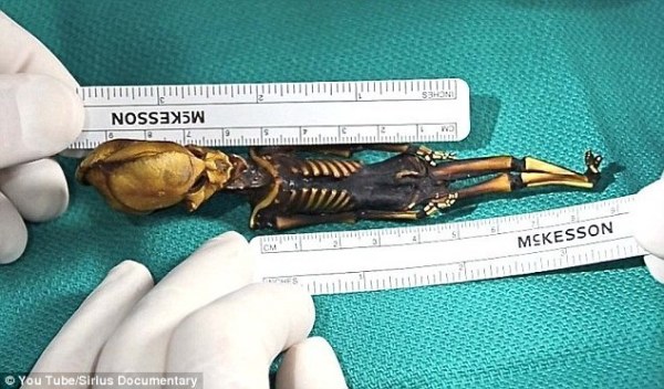 智利发现的迷你外星人被证实为人类突变