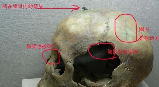 不忍直视!七张令人恐惧的考古发现图