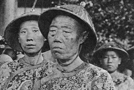 光绪死于砒霜中毒，溥仪认为袁世凯是凶手！