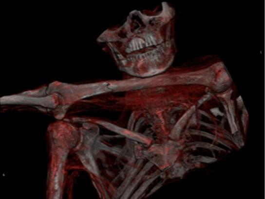 冰人奥茨：冰冻千年木乃伊发现过程揭秘