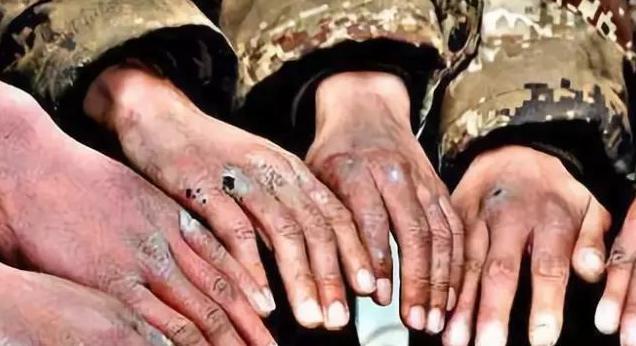 古代寒冷地区打仗,真的会冻掉士兵手指吗
